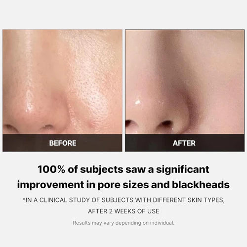 MEDICUBE Zero Pore Pad